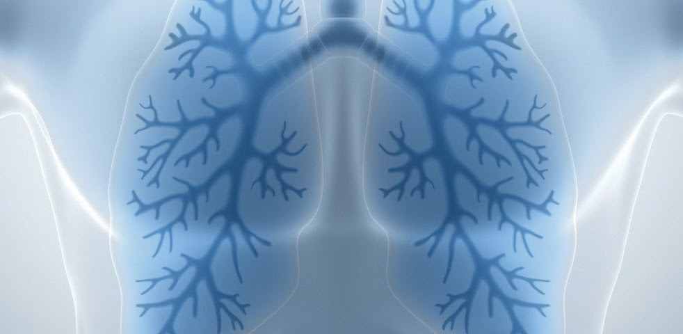 CFRI_CureCF's tweet photo. #TRIKAFTA RESCUES #CFTR AND LOWERS MONOCYTE P2X7R-INDUCED INFLAMMASOME ACTIVATION IN #CysticFibrosis
Researchers concluded that P2X7R may be a promising target to reduce inflammation in those with CF who are not eligible for #CFTRmodulator therapy.
https://t.co/EB3sw2iRmi https://t.co/Domda8XlfZ