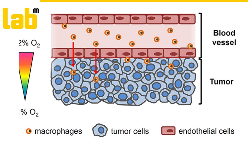 josbaema's tweet image. 1/3🧫A very interesting topic to fight against #cancer and #tumour growth. 🔬

🔬Novel experimental in vitro setting to reproduce different oxygenation patterns between the tumor-vessel interface🔬

labmethods.org/2021/11/19/nov…

#labmethods