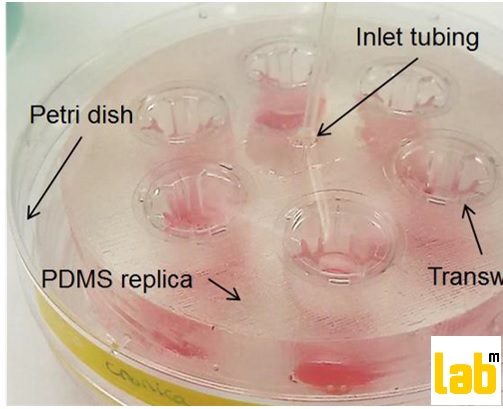 josbaema's tweet image. 1/3🧫A very interesting topic to fight against #cancer and #tumour growth. 🔬

🔬Novel experimental in vitro setting to reproduce different oxygenation patterns between the tumor-vessel interface🔬

labmethods.org/2021/11/19/nov…

#labmethods