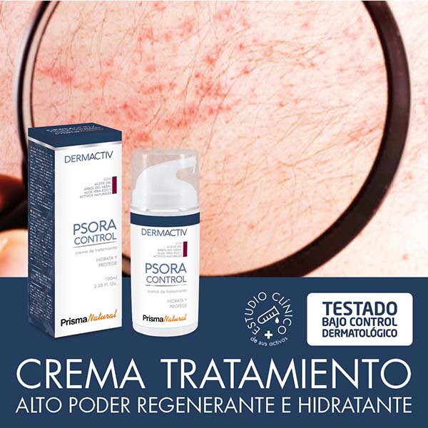 Prisma_Natural's tweet photo. La Psoriasis es una enfermedad de la piel que causa escamas en las rodillas, codos, tronco o cuero cabelludo. 
En Prisma Natural hemos dado con una formula para calmar y aliviar los síntomas. 
Si quieres saber más pincha en este enlace: 

👉https://t.co/XCgxGSWEHh https://t.co/DW3Ol1a3MJ