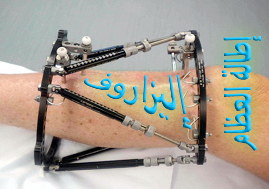 ݡ ( )   
