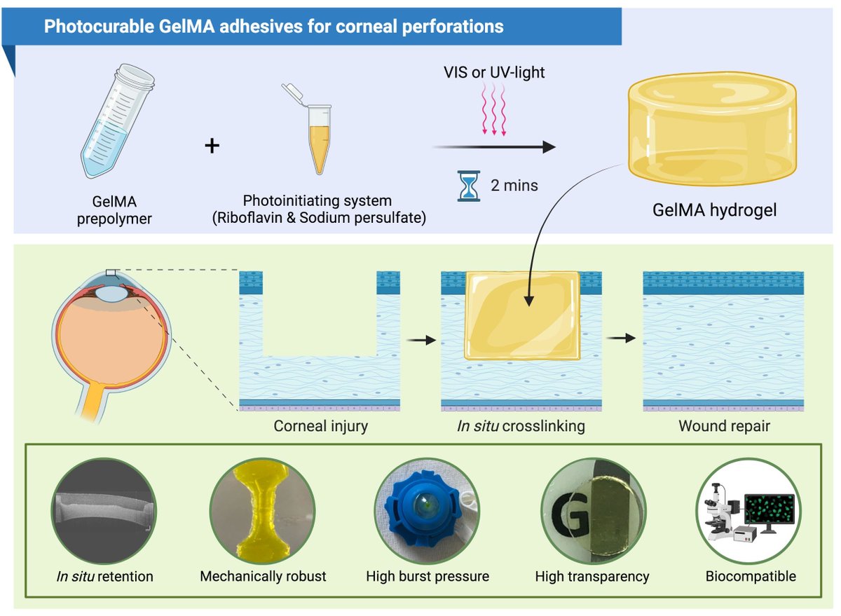 Super proud of the hard work @iniciativa__ put into the latest article from her #PhD developing photocurable GelMA adhesives for corneal perforations mdpi.com/2306-5354/9/2/… @anita_ghag @KennyMan888 @_TomERobinson #mdpibioengineering