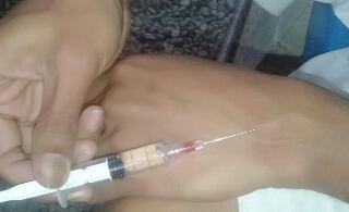 pseudo_nel's tweet photo. So bro learned how to inject himself. Working on the form though. https://t.co/mLBImoMdSU