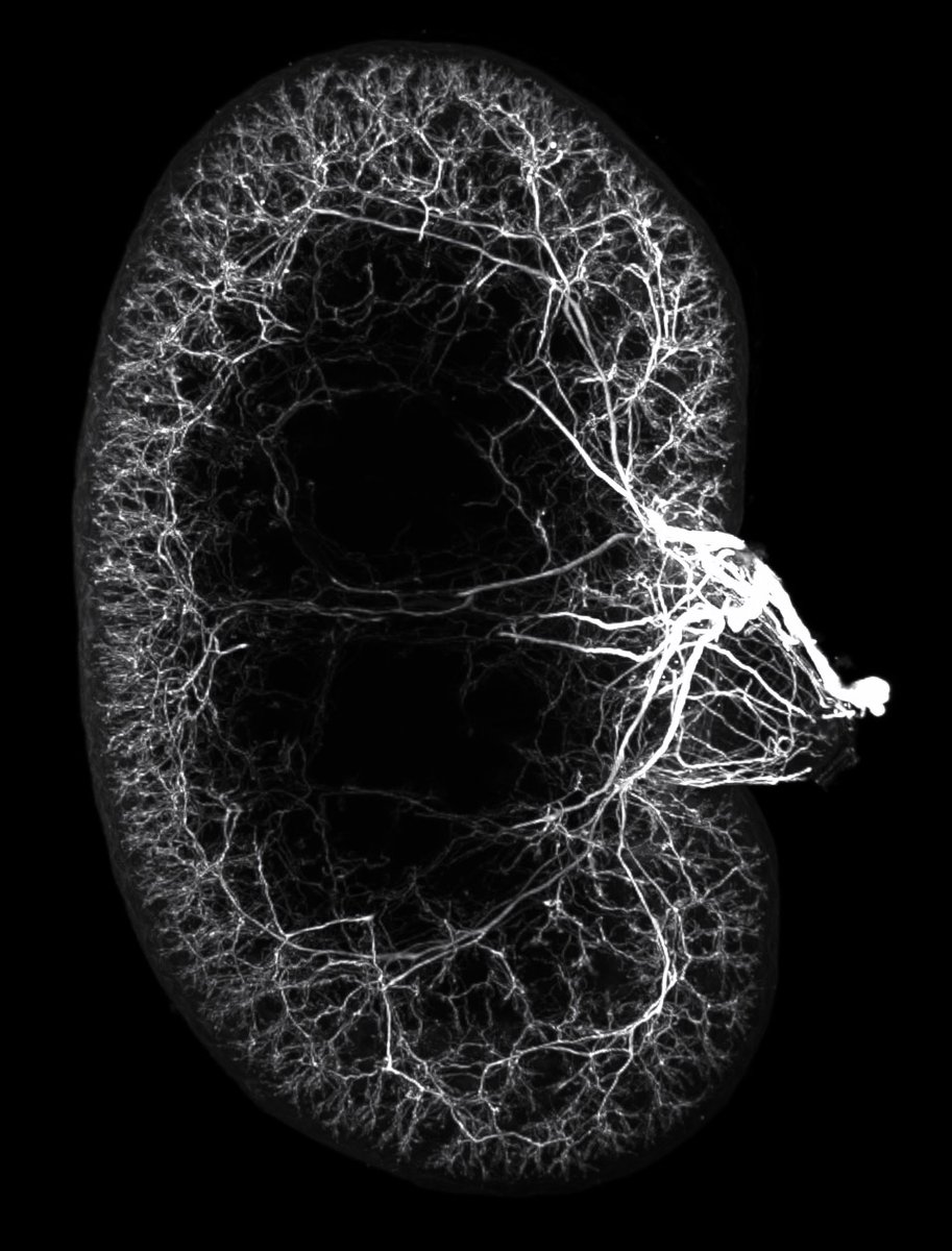 While we all strive for ideal experimental outcomes, failure happens. So, I present #FluorescenceFridayFails. Because it's good to have a laugh and learn something.
 
#1: I feel like something's missing here...(ab penetration issue) 1/6
