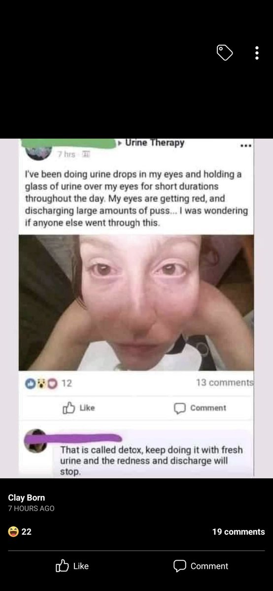 Arctic__char's tweet image. Check this out #urinetherapy