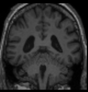 How brains can sometimes be spooky 👻 #MRI #research #PhDlife