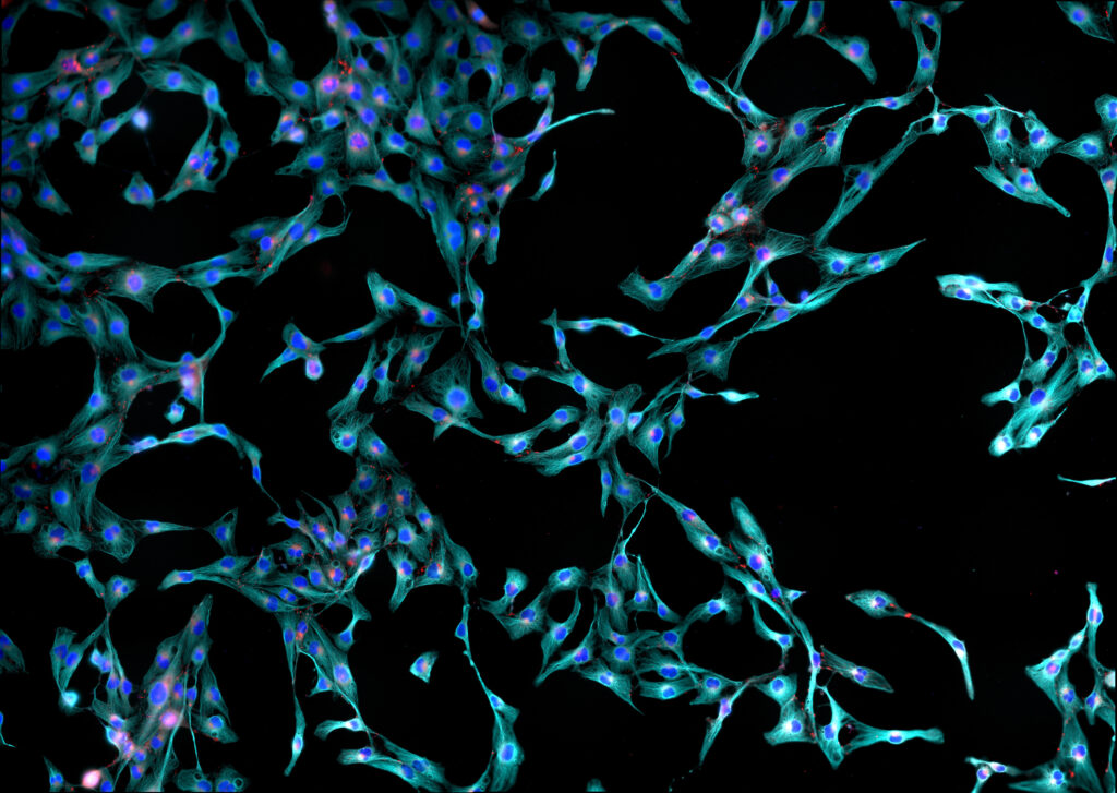 INBT_JHU's tweet photo. Don't miss the #JHUEngineering article about the new startup AbMeta Therapeutics founded by INBT co-founder and core researcher @DenisWirtz in the @HopkinsEngineer magazine's Winter 2022 issue, out last week. Read about it here: https://t.co/5TdPmHVSjZ https://t.co/cx4alOsdbu