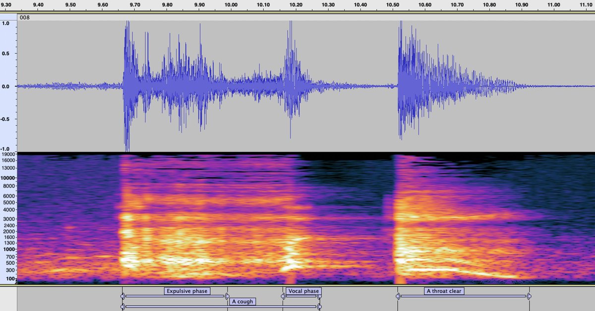hyfeapp's tweet photo. At Hyfe, our relentless pursuit to detect cough sounds, inevitably confronted us with something very similar to coughs: the “throat clear”.

Can you tell the differences in the waveform/spectrogram image?

#TheCoughFactFriday https://t.co/VCvRe3h9k8