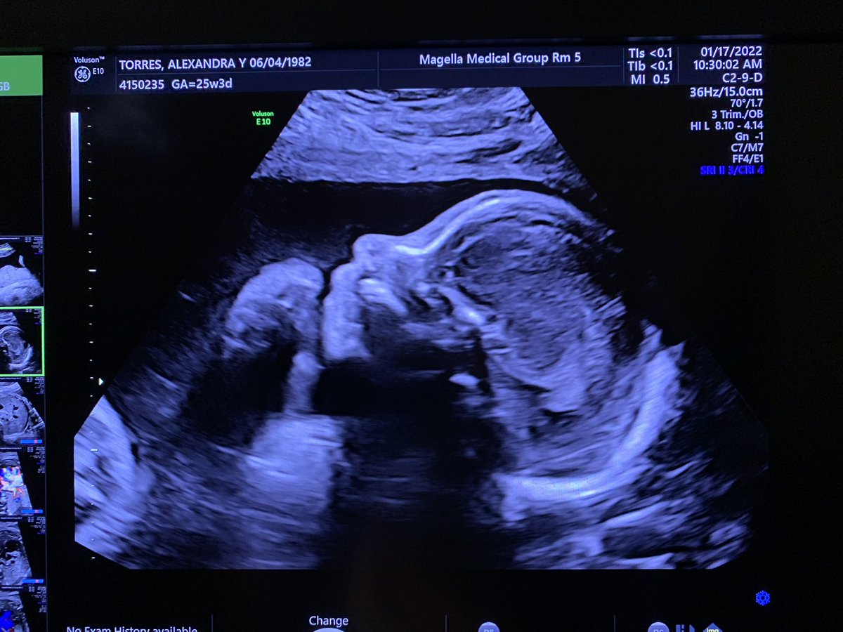 Super excited!!! #baby4