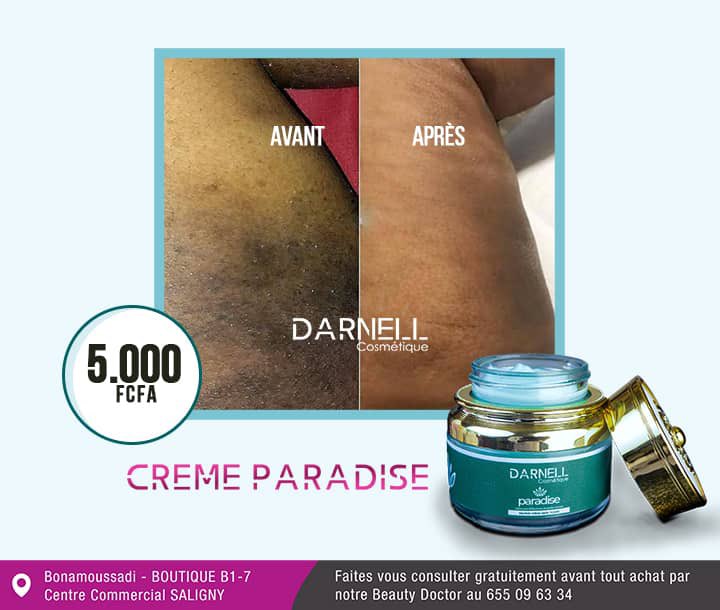 yemargent's tweet photo. Chacun prépare son GRAND MATCH à sa façon.
🇨🇲DOUALA 655096334
🇨🇲 YAOUNDÉ 656825430
🇫🇷FRANCE - EUROPE +33 7 66 89 49 26
#MadeInCameroon #vergeture https://t.co/y0MGaGsIPJ