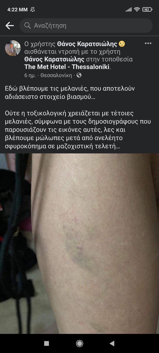 GkionisIlias's tweet photo. Ο Καρατσιώλης είναι ο δικηγόρος που εκπρόσωποι τους μάρτυρες που καταθέτουν εναντίων της μαρτυρίας του βιασμού της Γεωργίας. 
Και επειδή έχει κάνει μήνυση και αγωγή στο παρελθόν σε όποιον αναφέρει το όνομα του. 
Εγώ θα τον πάω μέχρι Ευρωπαϊκό δικαστήριο αν χρειαστεί. https://t.co/1lCJsj9qLO