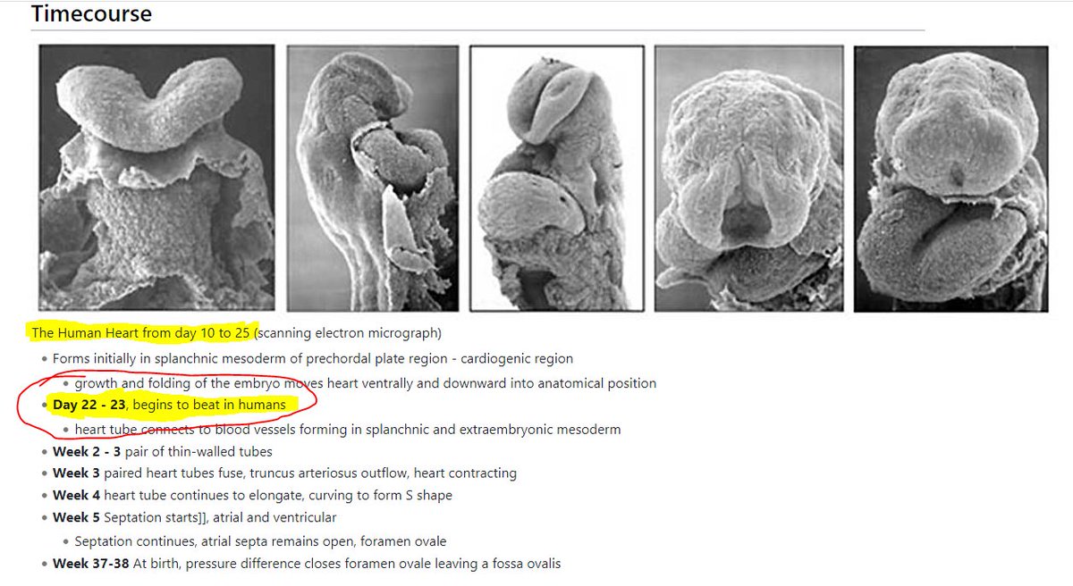 🤦‍♀️🤷‍♀️@APSouthRegion reports 'the heart doesn’t begin to form until the fetus is at least nine weeks old.' AP needs to follow the science!  Top embryology experts teach the human heart starts beating day 22 post-fertilization (that's 6 weeks gestation) 1/2

apnews.com/article/us-sup…