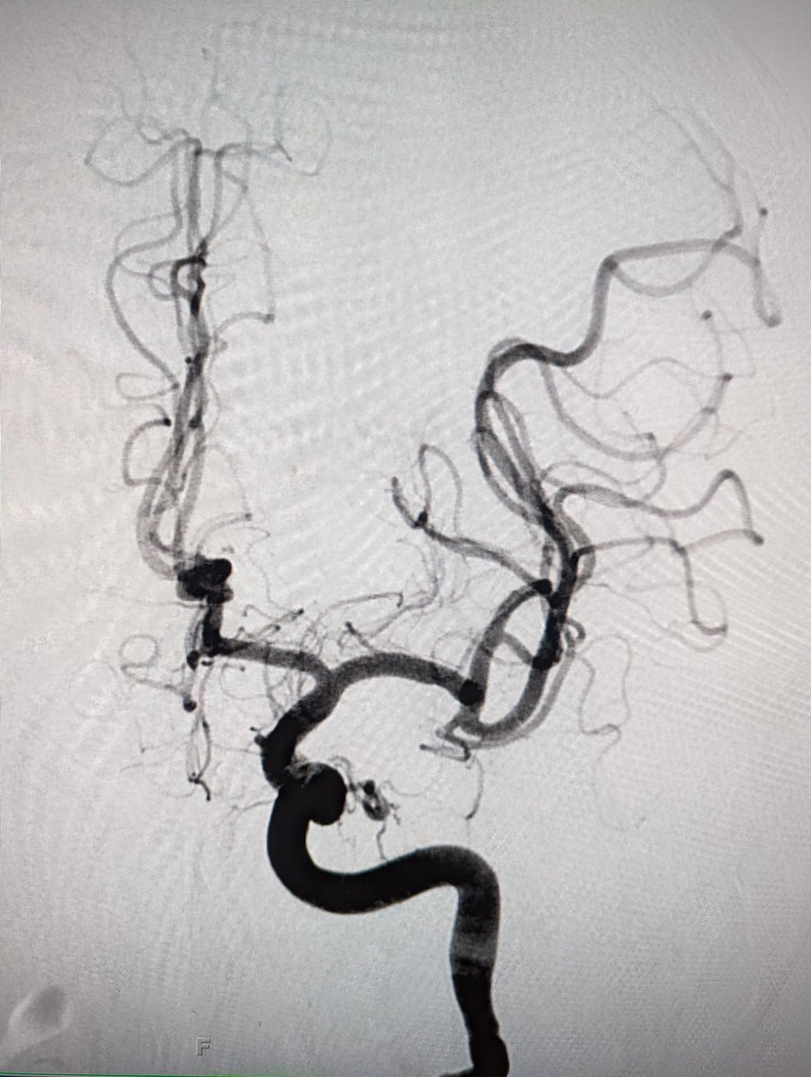 Abbott NIR tweet media