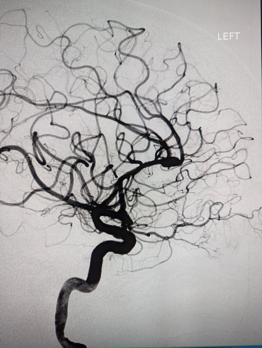 Abbott NIR tweet media