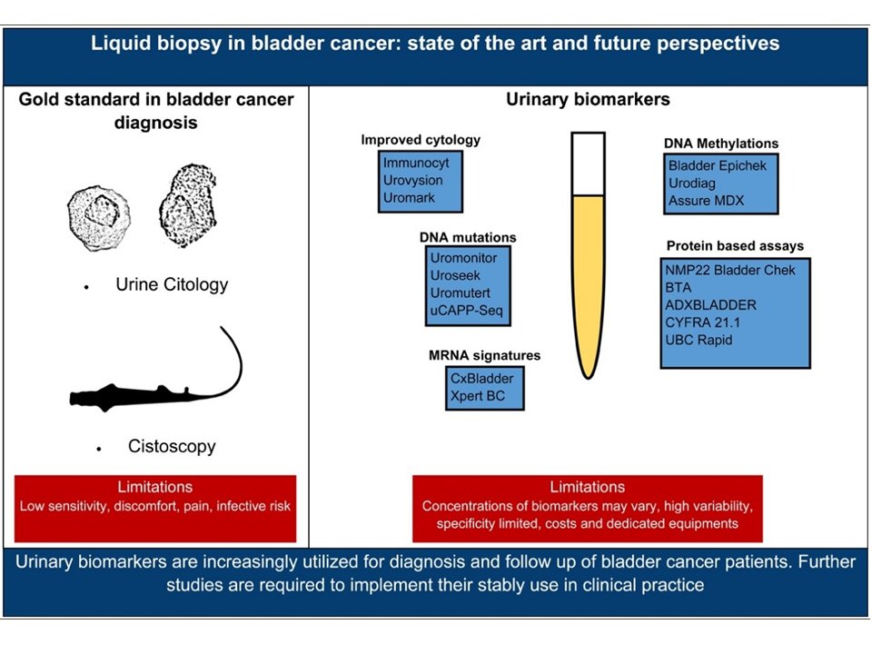 International Society of Liquid Biopsy (@isliquidbiopsy) on Twitter photo <a href="/isliquidbiopsy/">International Society of Liquid Biopsy</a> In the Spotlight: "Liquid biopsy in bladder cancer: State of the art and future Perspective". sciencedirect.com/science/articl…. <a href="/ChristianRolfo/">Christian Rolfo</a>
<a href="/MJOSESERRANO19/">M JOSE SERRANO Lab (LB&Cancer Interception group)</a>
<a href="/UmbertoMalapel1/">Umberto Malapelle</a> <a href="/drgandara/">David Gandara</a> <a href="/ElJanLe/">ELO</a> @MCristofanill <a href="/isliquidbiopsy/">International Society of Liquid Biopsy</a> In the Spotlight: "Liquid biopsy in bladder cancer: State of the art and future Perspective". sciencedirect.com/science/articl…. <a href="/ChristianRolfo/">Christian Rolfo</a>
<a href="/MJOSESERRANO19/">M JOSE SERRANO Lab (LB&Cancer Interception group)</a>
<a href="/UmbertoMalapel1/">Umberto Malapelle</a> <a href="/drgandara/">David Gandara</a> <a href="/ElJanLe/">ELO</a> @MCristofanill