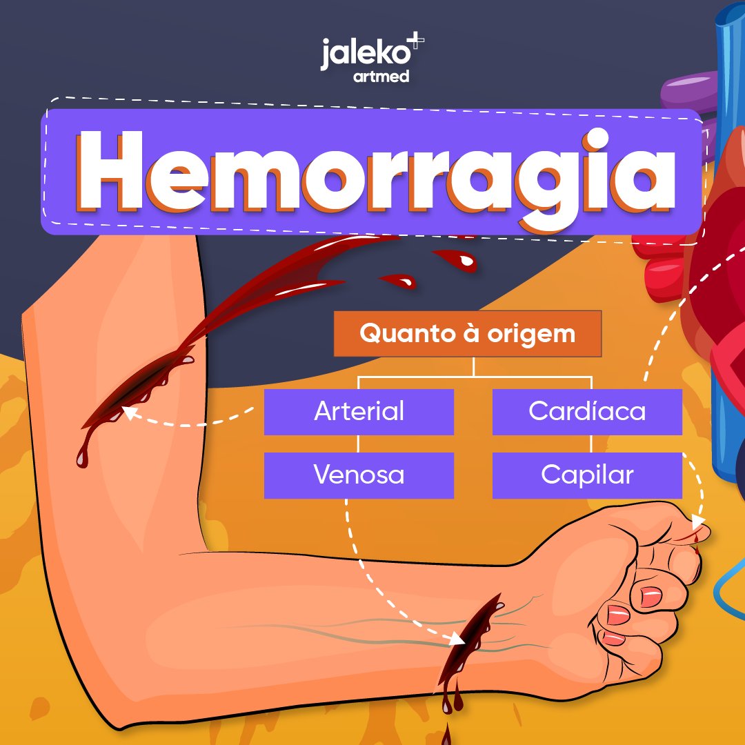 JalekoAcad's tweet photo. Hemorragia é a perda sanguínea em decorrência da ruptura de vasos sanguíneos do sistema circulatório. 🩸

Entenda como as hemorragias são classificadas de acordo com sua origem, intensidade, morfologia e etiologia! 😃 https://t.co/yJvFI6UGje