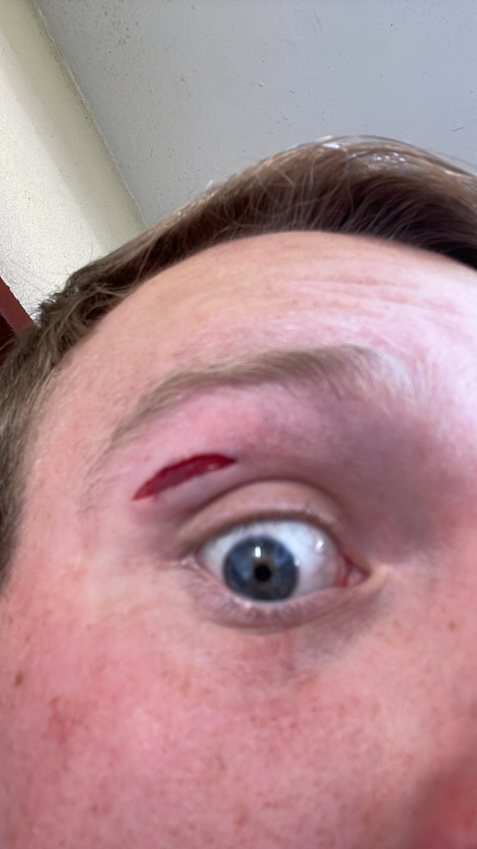 “Non-contact sport”