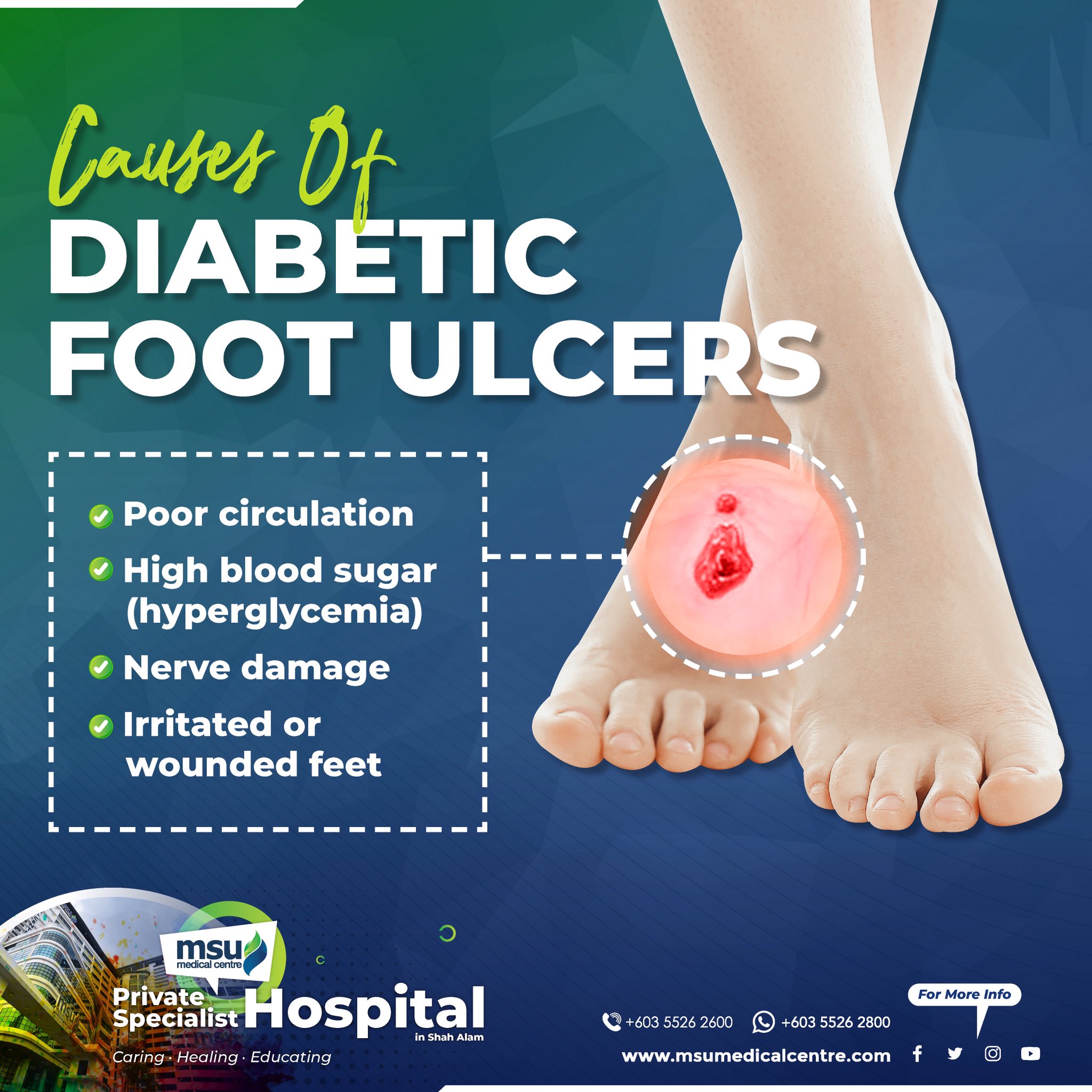 Diabetic Foot Ulcer Stages - Atlanta Wound Doctor Explains