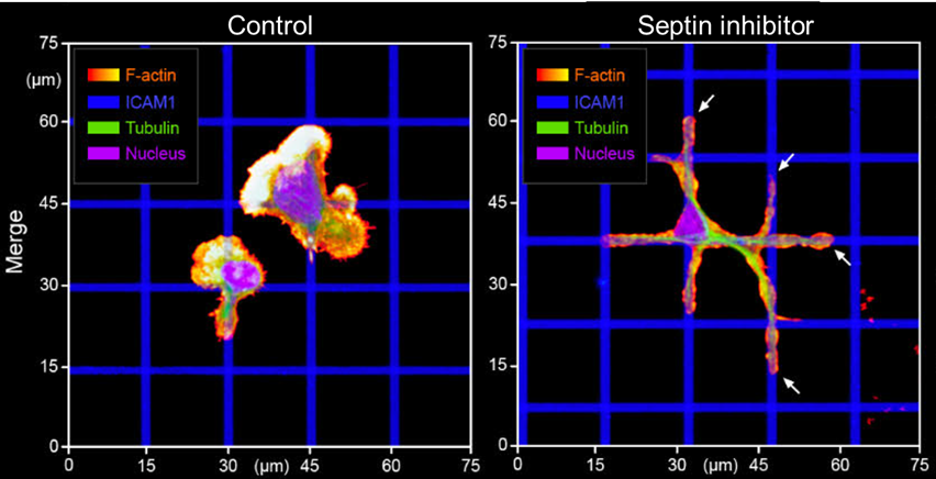 pj_saez's tweet photo. Depending on cytoskeleton dynamics &amp; the need of #FocalAdhesion, cell migration comes in 2 flavors (at least): amoeboid &amp; mesenchymal.
Immune cells generally use ameboid motility mode.
Surprisingly, #septin inhibition switched T cell migration to a more mesenchymal one! 
#science https://t.co/cUNZQSggPY