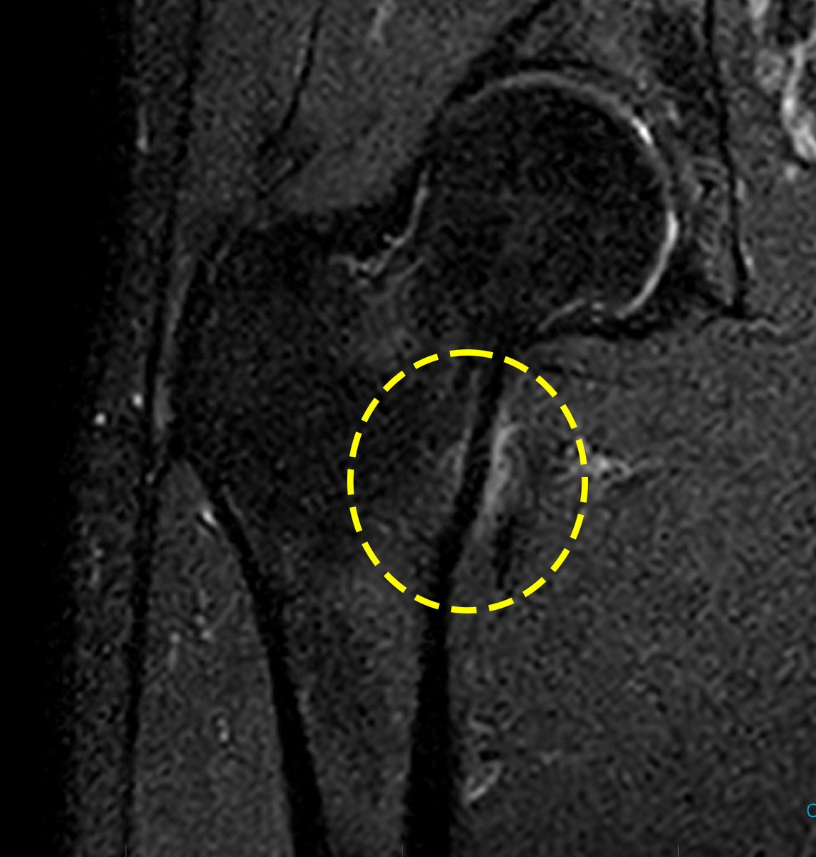 Stuart Warden, PT, PhD, FACSM, FASBMR tweet media