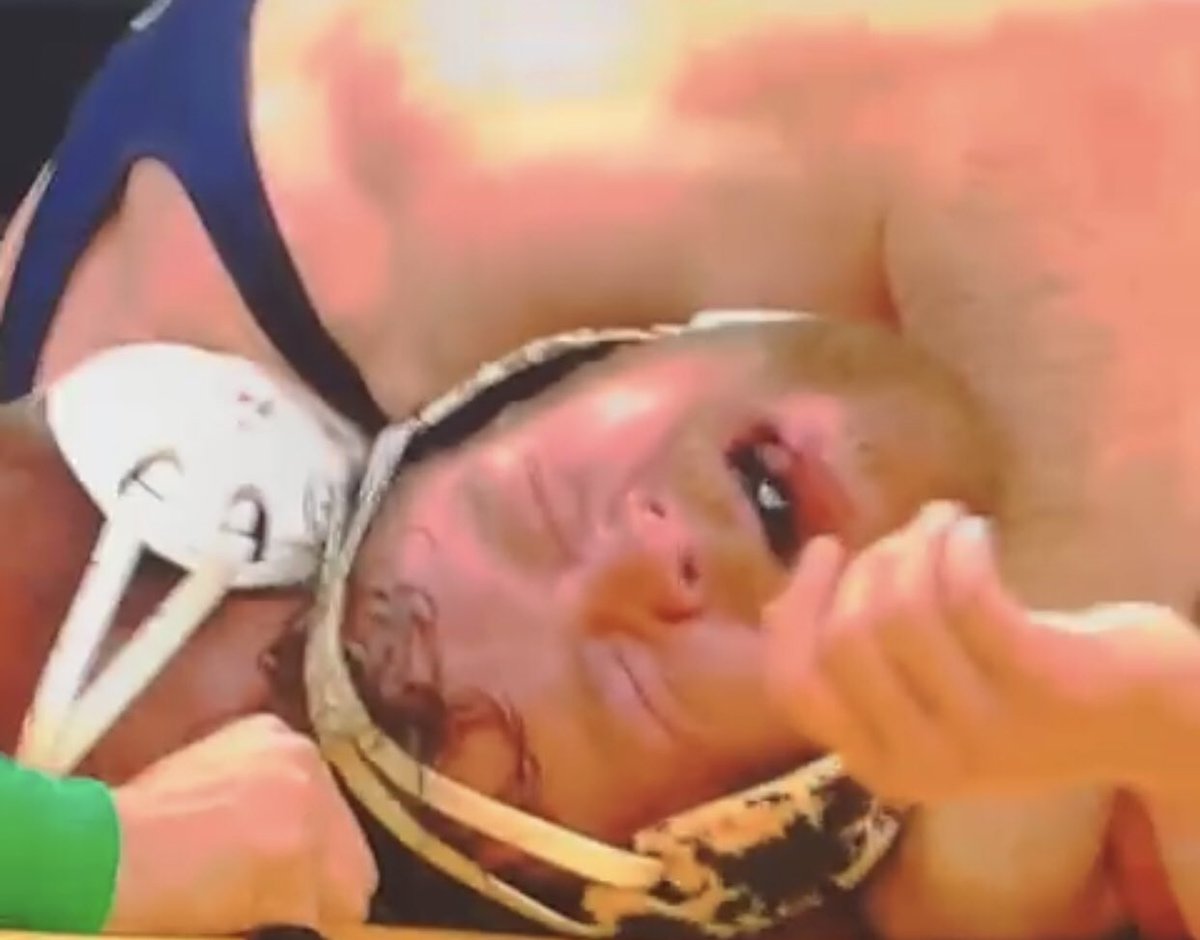 StuffSomersSays's tweet photo. Idk this pain looks fake. https://t.co/fcIGFS7Hwm