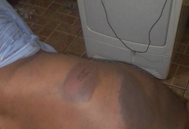 EmmanuelGumbo_'s tweet photo. Our only crime was putting on yellow t-shirts, which they alleged that it was disorderly conduct &amp; later changed to obstruction. Which they saw fit to subject us to brutal torture &amp; degrading human conditions during our detention.Nevertheless, the struggles continues unabated. https://t.co/U9C47QnFQO