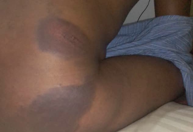 EmmanuelGumbo_'s tweet photo. Our only crime was putting on yellow t-shirts, which they alleged that it was disorderly conduct &amp; later changed to obstruction. Which they saw fit to subject us to brutal torture &amp; degrading human conditions during our detention.Nevertheless, the struggles continues unabated. https://t.co/U9C47QnFQO