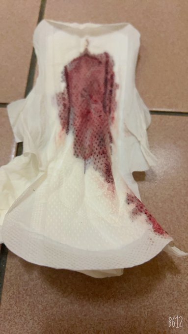 月經提早來了😣 有在露天下標的買家要等奈々子囉 https://t.co/gNsteyEqI2<a href="/tag/%E5%8E%9F%E5%91%B3"class="tags"><span>#原味</span></a>