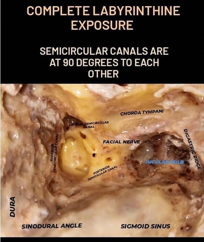 entkmcmlr's tweet photo. Temporal bone dissection by our postgraduates https://t.co/AqoPHHEgnF