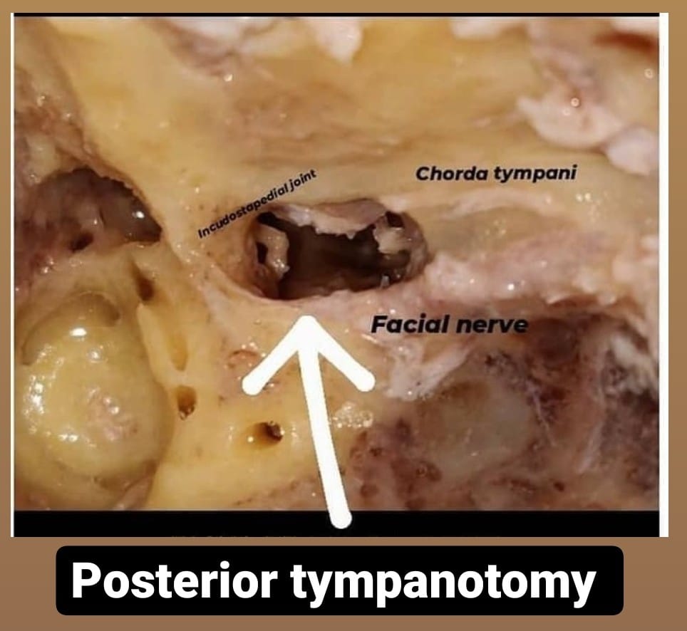 entkmcmlr's tweet photo. Temporal bone dissection by our postgraduates https://t.co/AqoPHHEgnF