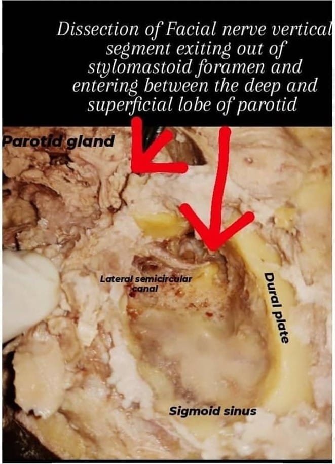 entkmcmlr's tweet photo. Temporal bone dissection by our postgraduates https://t.co/AqoPHHEgnF