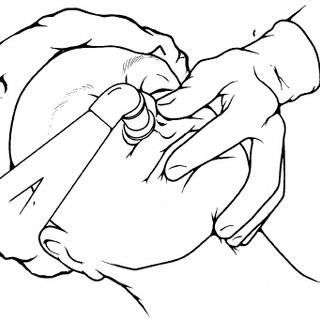 NaveenEipe's tweet image. And for the 'not so difficult AWs' or 'less likely to get into trouble' situations 
[E.g. #MObesity #CSpines #OSA]

there is always the #ModNasalTrumpet!