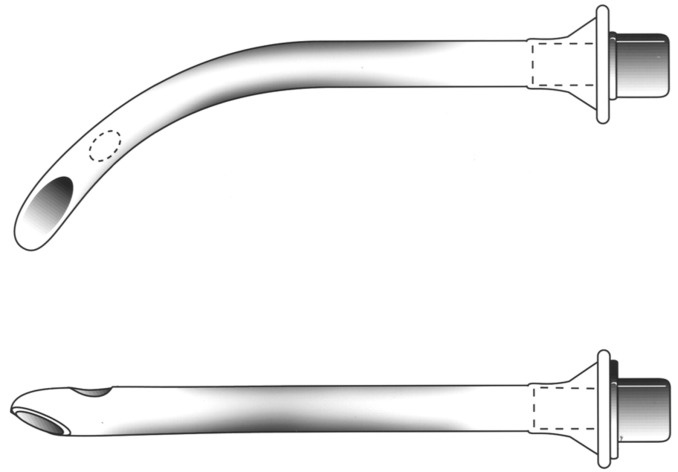 NaveenEipe's tweet image. And for the 'not so difficult AWs' or 'less likely to get into trouble' situations 
[E.g. #MObesity #CSpines #OSA]

there is always the #ModNasalTrumpet!