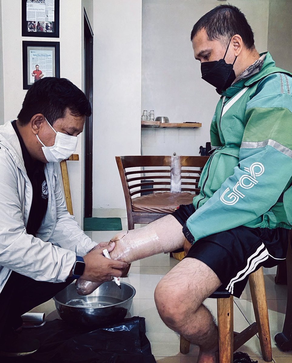 Hari ini ketemu sama seseorang yg daya juangnya luar biasa. Diamputasi dan gabisa beli kaki palsubuat beraktifitas, akhirnya bikin kaki palsu sendiri nonton tutorial di youtube. Bikin dari knalpot motor, ngelas besi untuk tiangnya &amp; untuk kakinya pake cetakan kayu untuk sepatu.