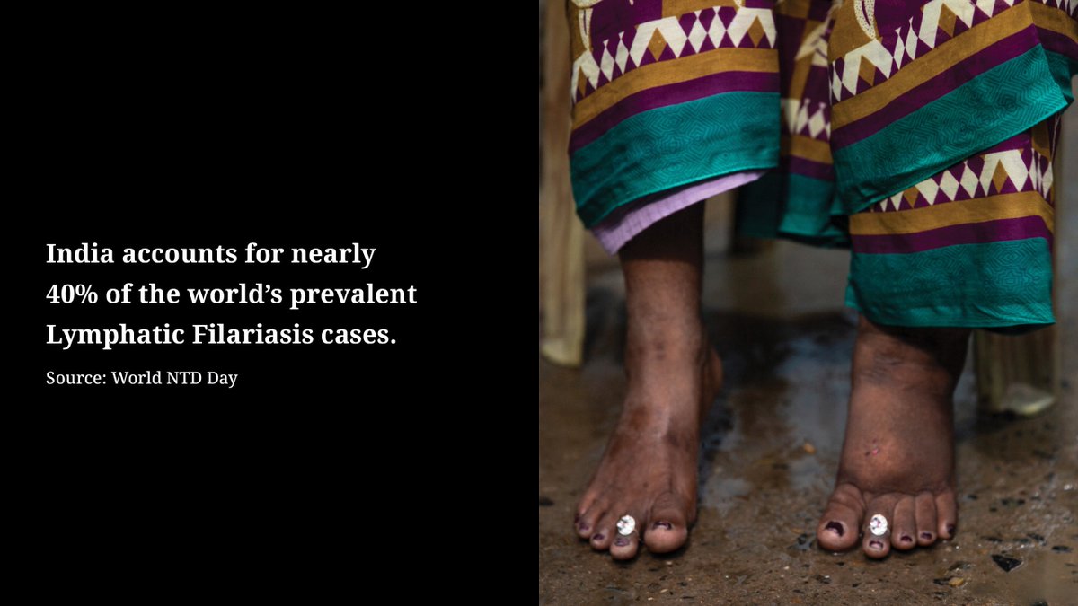 Gates Foundation India (@bmgfindia) on Twitter photo #Filaria spreads through mosquitos and causes long term disability. In 2018, India became the first country in South-East Asia to introduce the #MassDrugAdministration (MDA), with the aim to accelerate the elimination of #Filaria. <a href="/NTDFreeIndia/">NTD Free India</a> <a href="/GHS/">Global Health Strategies</a> #EndTheNeglect #IndiaWillEndLF #Filaria spreads through mosquitos and causes long term disability. In 2018, India became the first country in South-East Asia to introduce the #MassDrugAdministration (MDA), with the aim to accelerate the elimination of #Filaria. <a href="/NTDFreeIndia/">NTD Free India</a> <a href="/GHS/">Global Health Strategies</a> #EndTheNeglect #IndiaWillEndLF