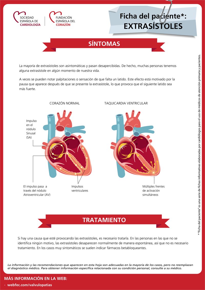 Extrasístoles, ¿qué son y por qué aparecen?
fundaciondelcorazon.com/blog-impulso-v…
