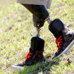 Photo by MCOP Prosthetics (@MedicalCenterOP)