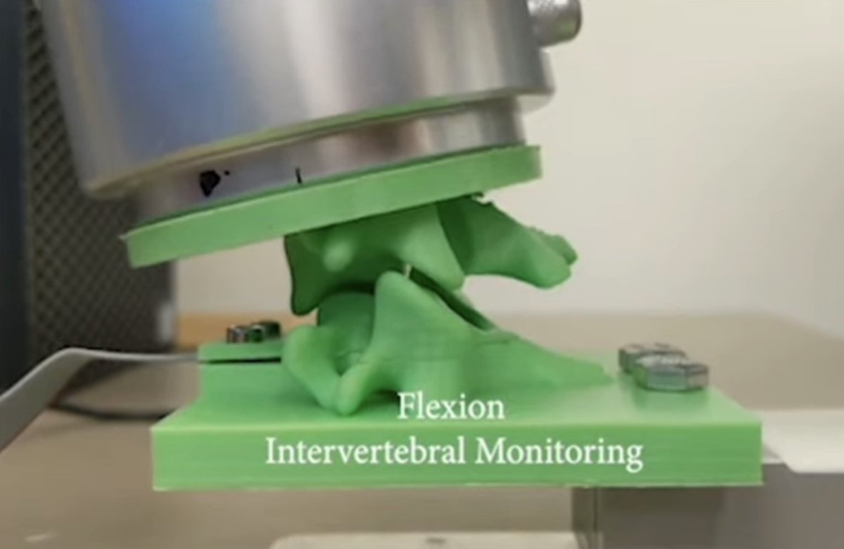 USAnesthesia's tweet photo. Robotic Spinal Replica for Surgical Planning
 https://t.co/v4eKyEb47y
 3D-printed replica of a portion of the human spine https://t.co/IE9Maigq0R