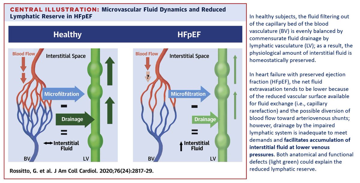 Reduced Lymphatic Reserve in Heart Failure With Preserved Ejection Fraction 🤔
#Medtwitter discussions always stimulate intellectual curiosity!
🔗sciencedirect.com/science/articl…
Cc <a href="/Rajiv_Sinanan/">Rajiv</a>