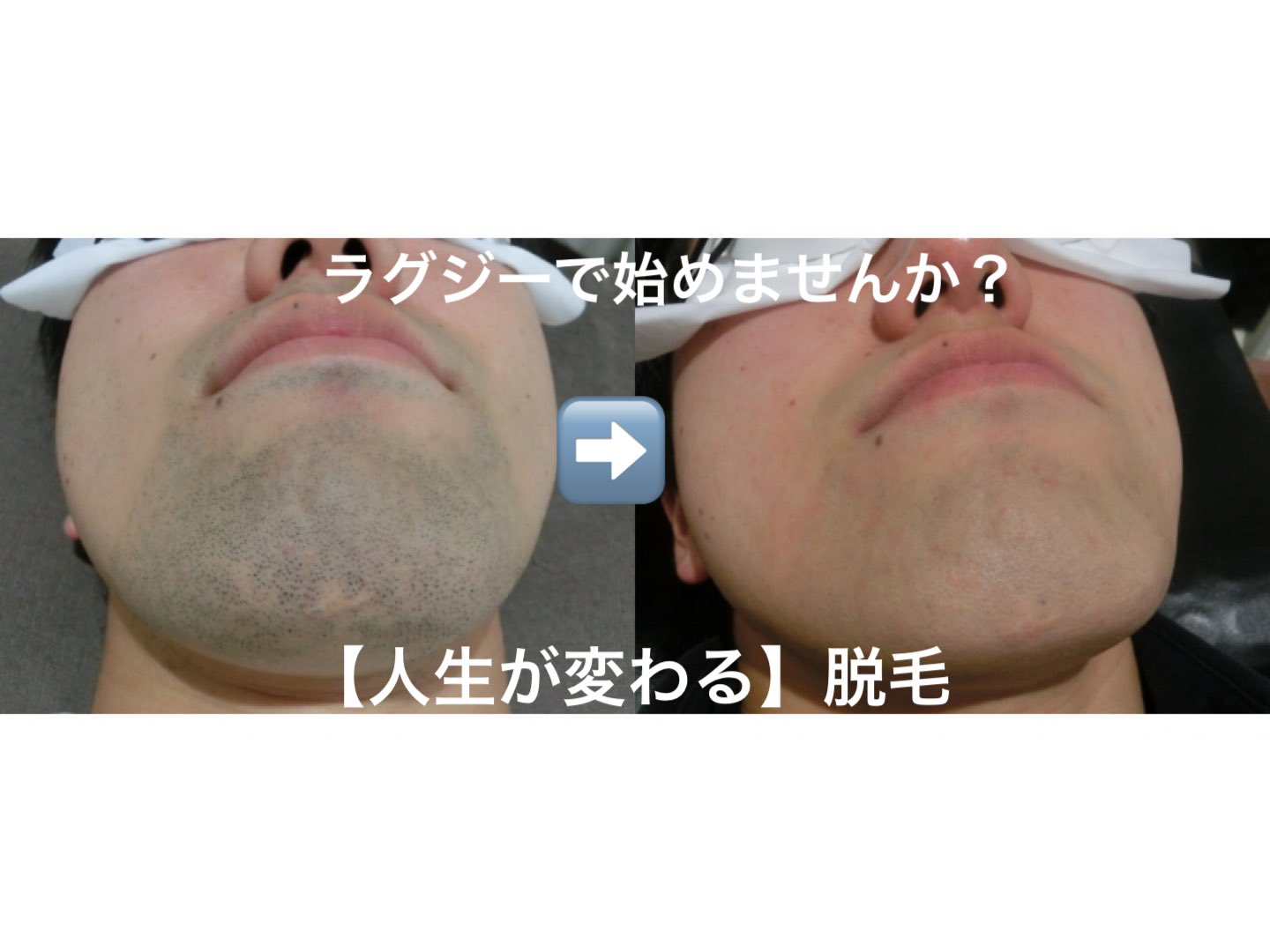 髭濃い Twitter Search Twitter