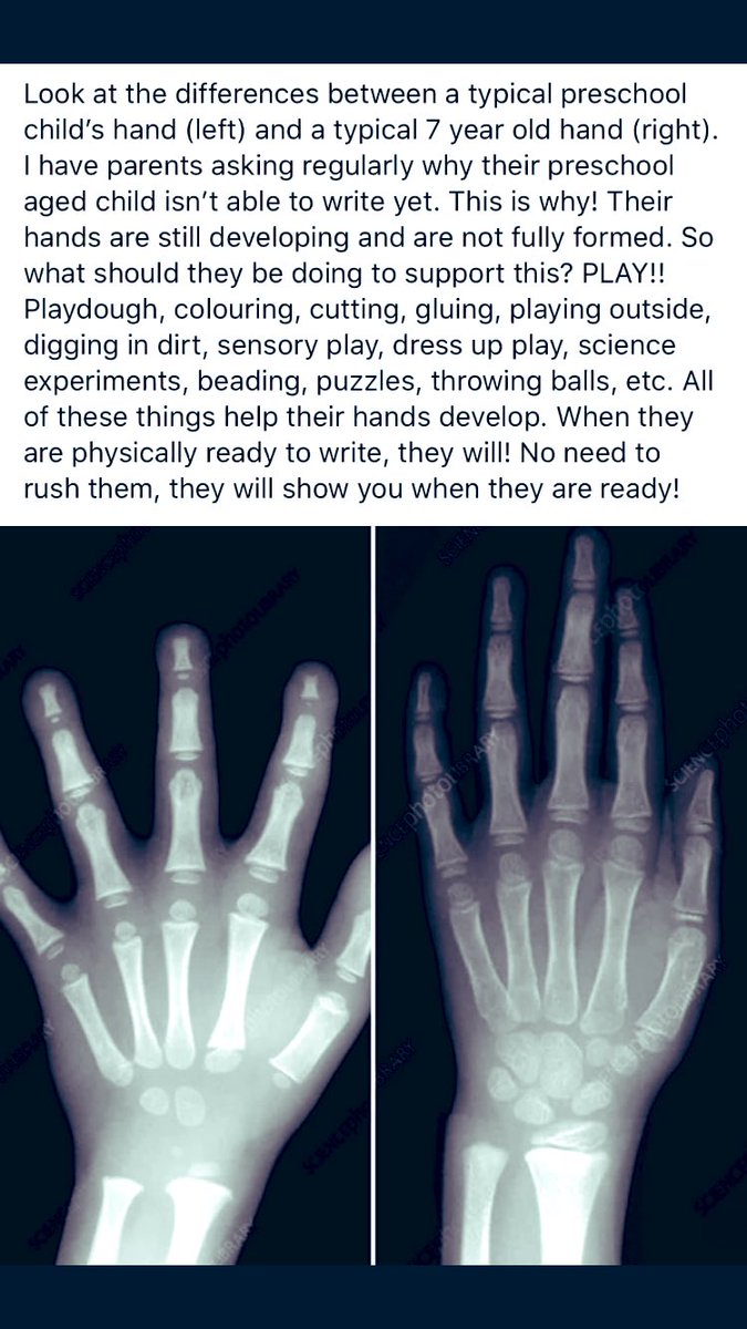 JilksyLaura's tweet photo. Always worth sharing. P1 &amp; P2 hands are still developing. Play is always the way ✋ https://t.co/R2E42enbUg