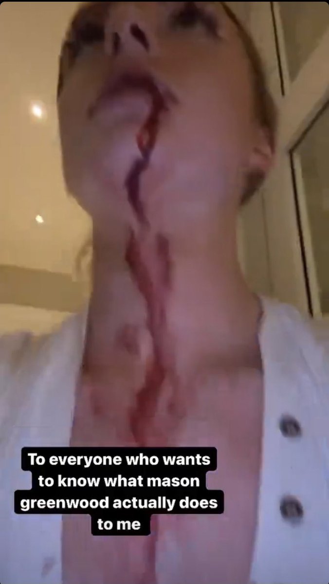 Kalo dr kacamata awam mimin, karir Greenwood sudah habis.

Klub tdk akan mengambil resiko 'memaafkan' public enemy. Tp kita lihat saja beberapa hari kedepan.