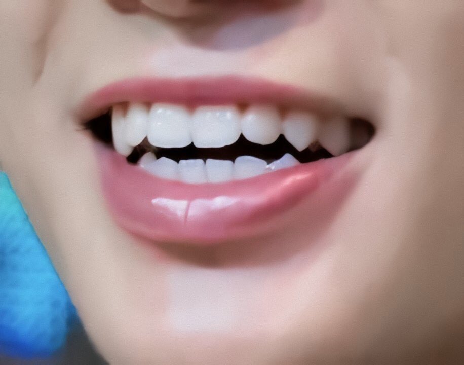 memoa304's tweet photo. I'm currently simping over his fangs and cuteee smile.. https://t.co/2kuDOQC7qg