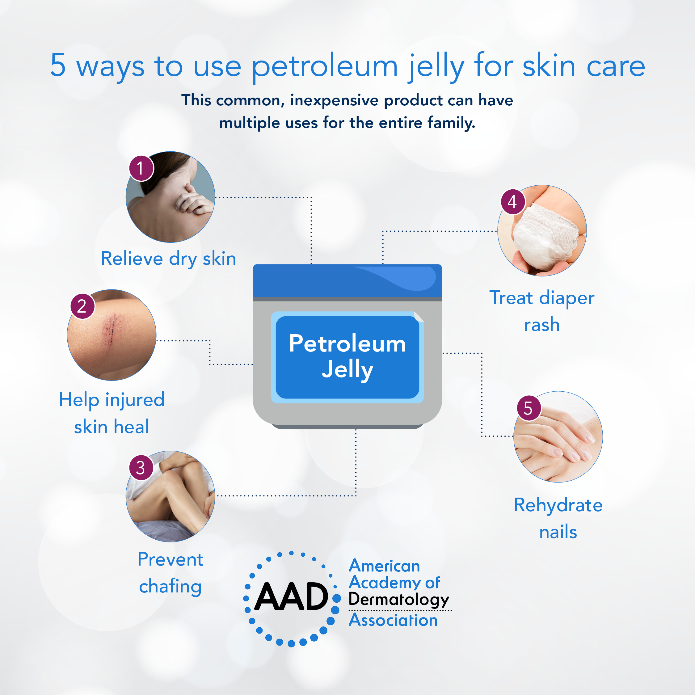 AAD on Twitter: "Petroleum jelly is an inexpensive product that can address  many skin concerns from head to toe. Here are a few ways to use it to  achieve #YourHealthiestSkin: https://t.co/stiFBYgXVR  https://t.co/f9vcQvrIqO" /