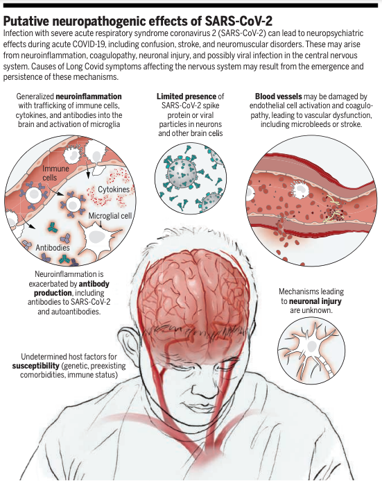 ScienceMagazine's tweet photo. A new #SciencePerspective discusses the neurological symptoms that accompany #COVID19 and the possible mechanisms that cause them. 

Read more ➡ https://t.co/WKZpnWlbNc https://t.co/Ma0gB6ZfAm