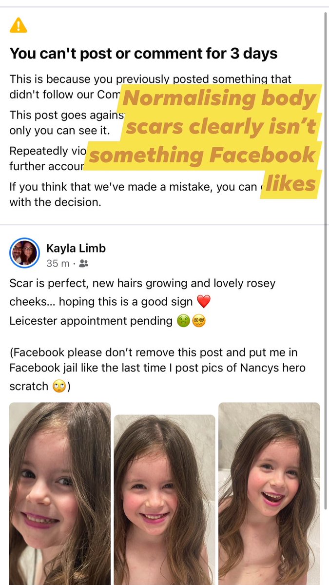 kaydee_x's tweet photo. @Meta Will your discriminating ways also stay the same? Shaming my 4 year olds scar? https://t.co/2qzEsN7cou