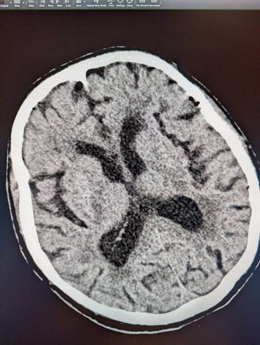 Abbott NIR tweet media