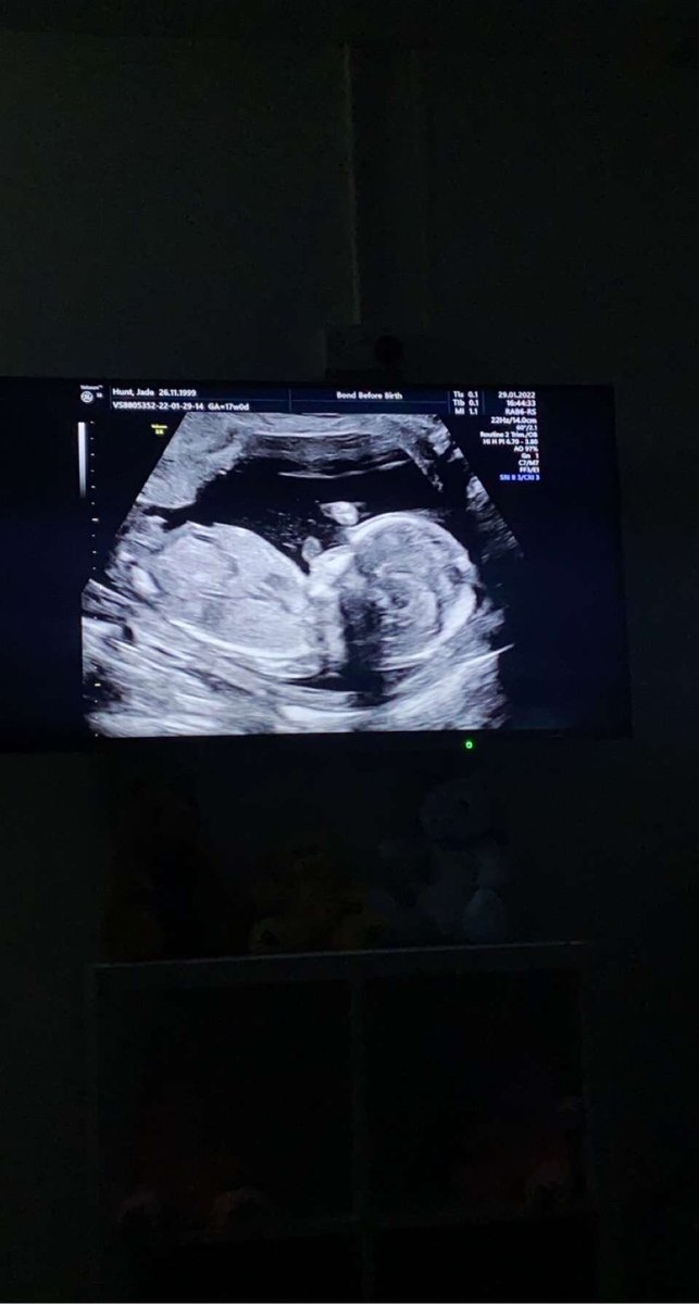 My boy💙