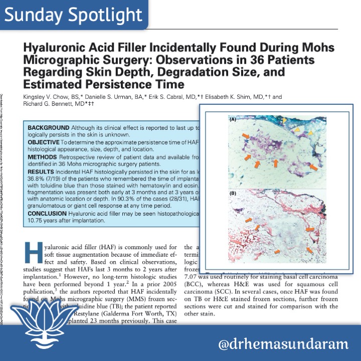 How long does #filler last? Longer than you'd think! 36 pts having #mohssurgery for #skincancer had filler nearly 11 yrs post-injection. This is why fillers should be used with respect - for longterm restoration not as space-occupying lumps. Read more instagram.com/drhemasundaram/
