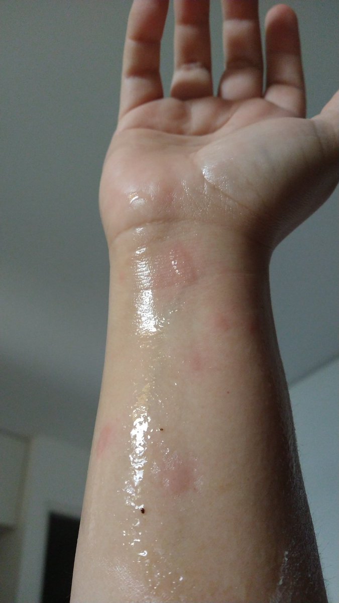 verdadyduele's tweet photo. Porque hasta a la más macha, le salpica el aceite caliente del sartén 😢 #supremas https://t.co/NYAJXeBZef